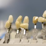 Obecna technika wykorzystywana w salonach stomatologii estetycznej być może spowodować, że odzyskamy ładny uśmieszek.